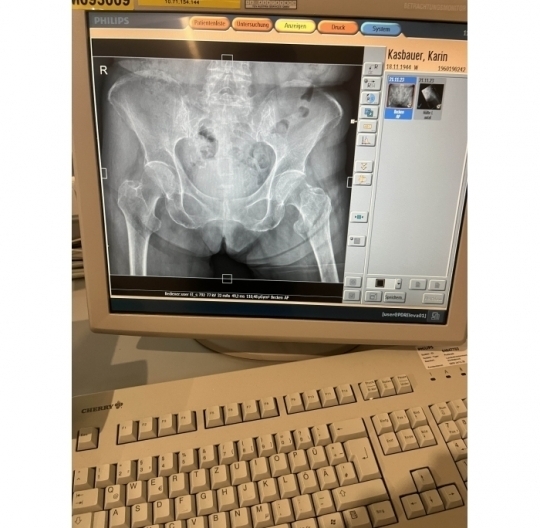 x-ray diagnostic monitor