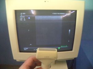 SIEMENS - L10-5