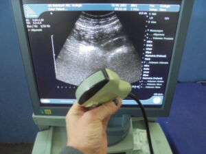 B&K MEDICAL - Type 8801