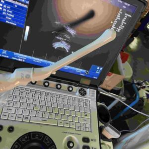 GE MEDICAL - E8C-RS