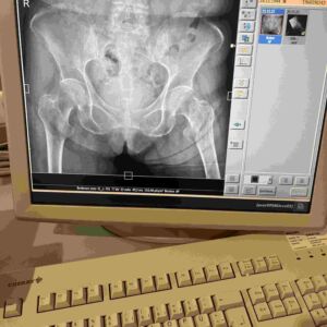 PHILIPS - x-ray diagnostic monitor