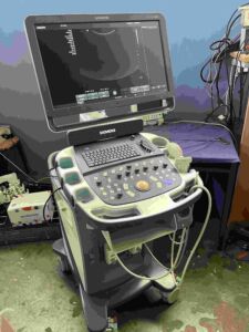 SIEMENS - Acuson X600