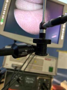 STORZ - Telecam 20210031 PAL
