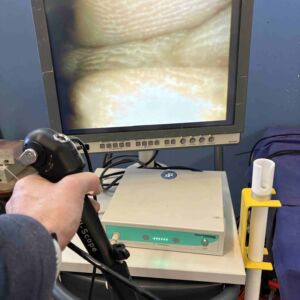 ACUTRONIC - Vi-Scope